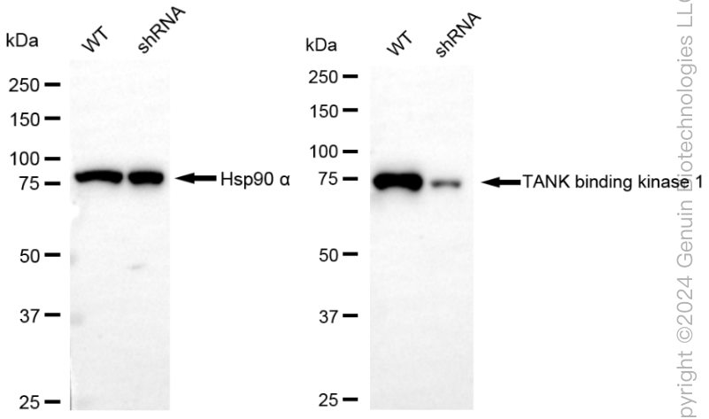 WB - KD-Validated Anti-TANK Binding Kinase 1 Rabbit Monoclonal Antibody AGI1845
